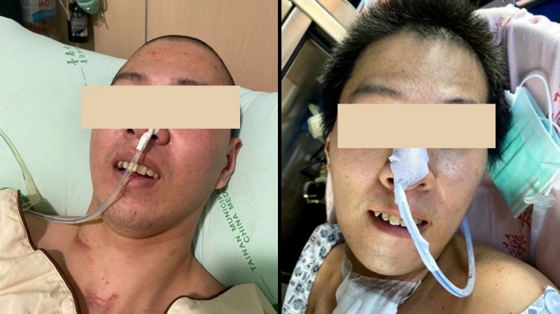 Taiwan man wakes from year-long coma after magnetic stimulation
