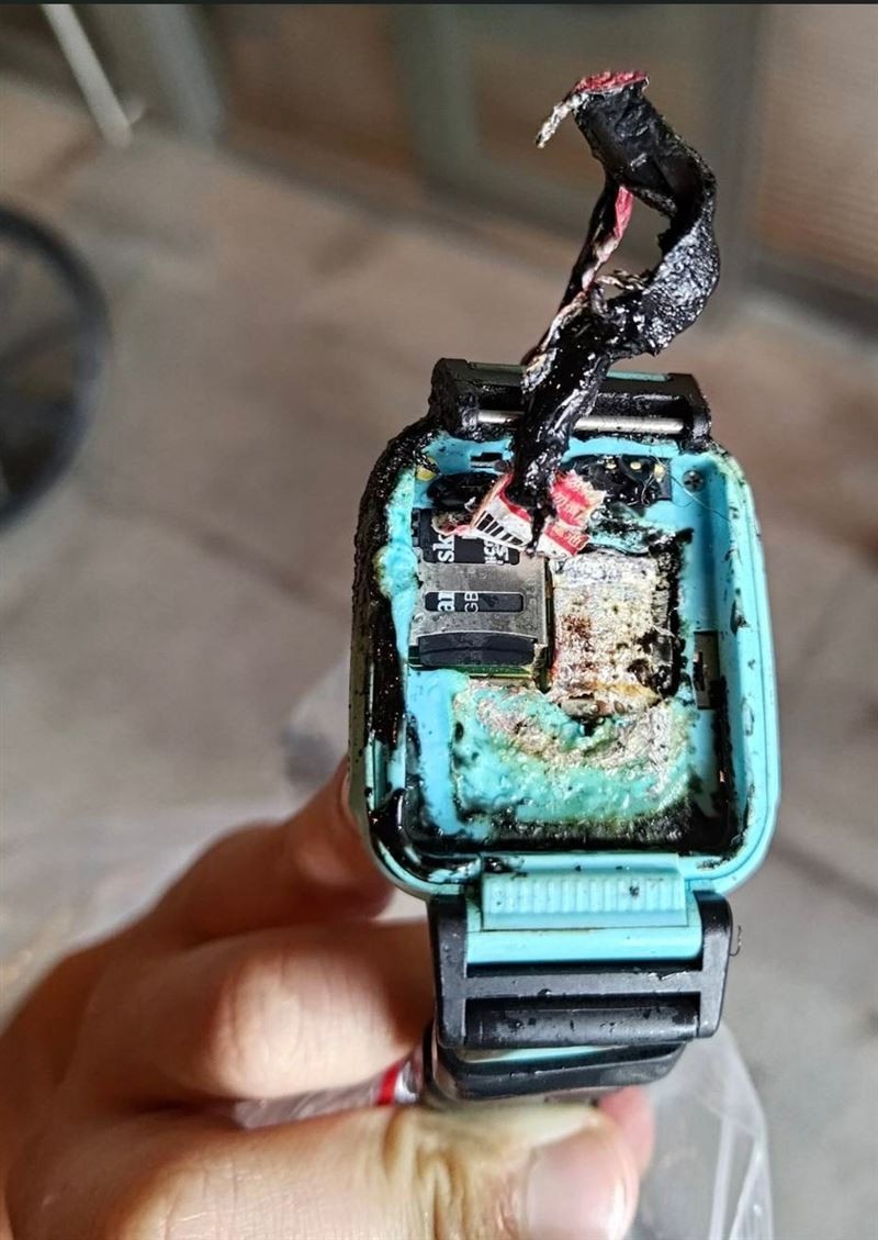 New Taipei boy suffers 2nd degree burns from smartwatch explosion