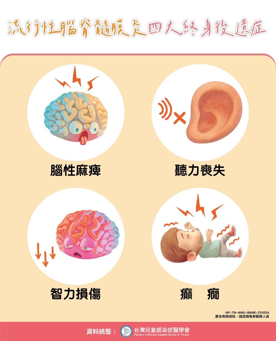 230萬台灣人無症狀帶菌者！流行性腦脊髓膜炎症狀如感冒、致死率高 醫：快帶嬰幼兒接種疫苗