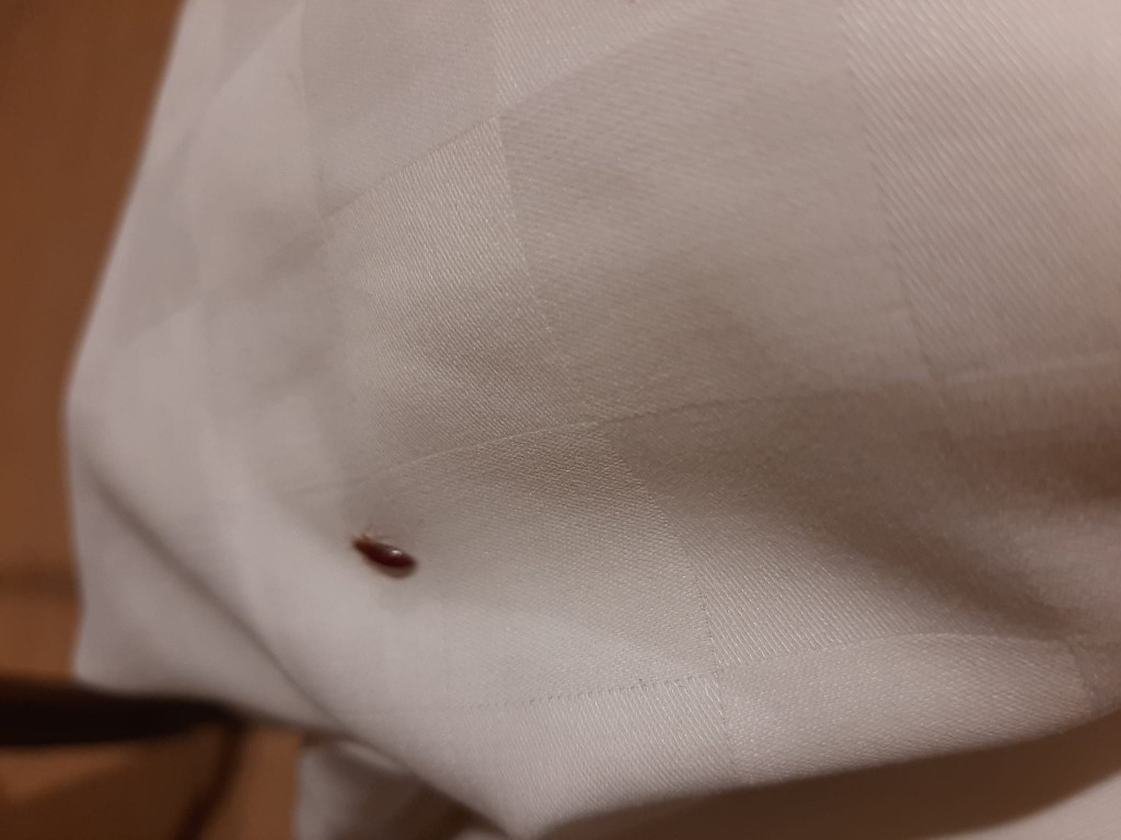 Guest suspects bedbugs in Taipei hotel